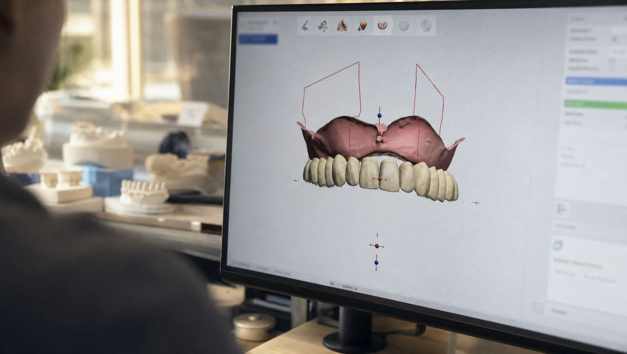 Illustration of denture design on a computer in a laboratory