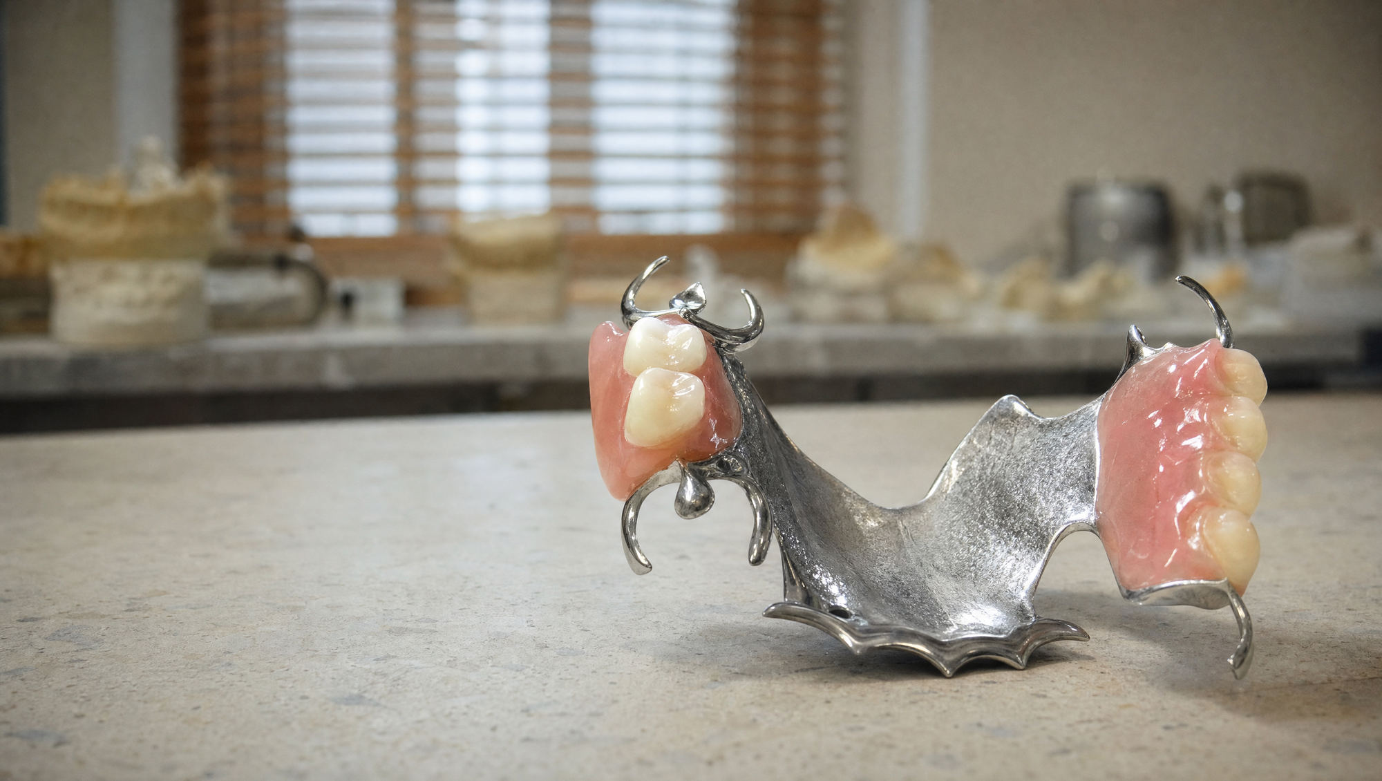 Illustration of a metal partial denture on a studio bench