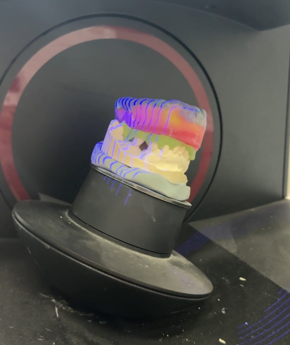 Laboratory scanner recording a denture model, not a scan inside the mouth
